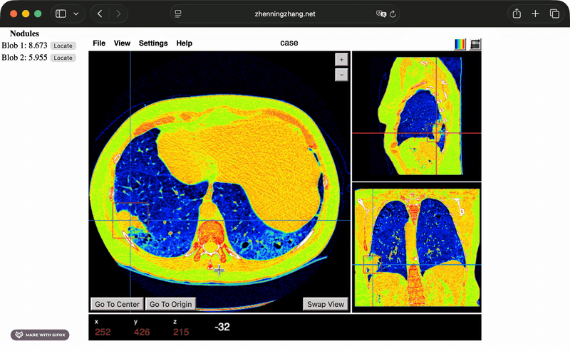 Papaya DICOM viewer screen recording